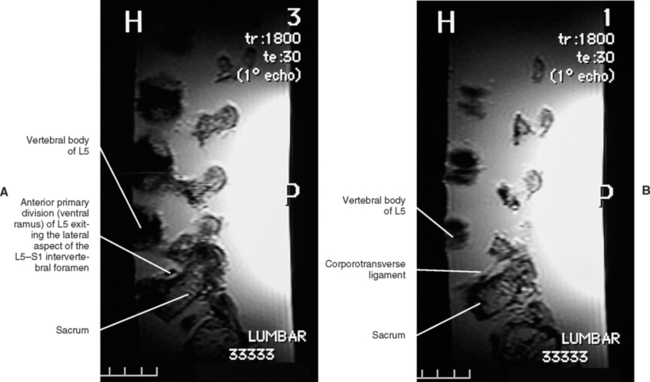 Surface Anatomy Of The Back And Vertebral Levels Of Clinically ...