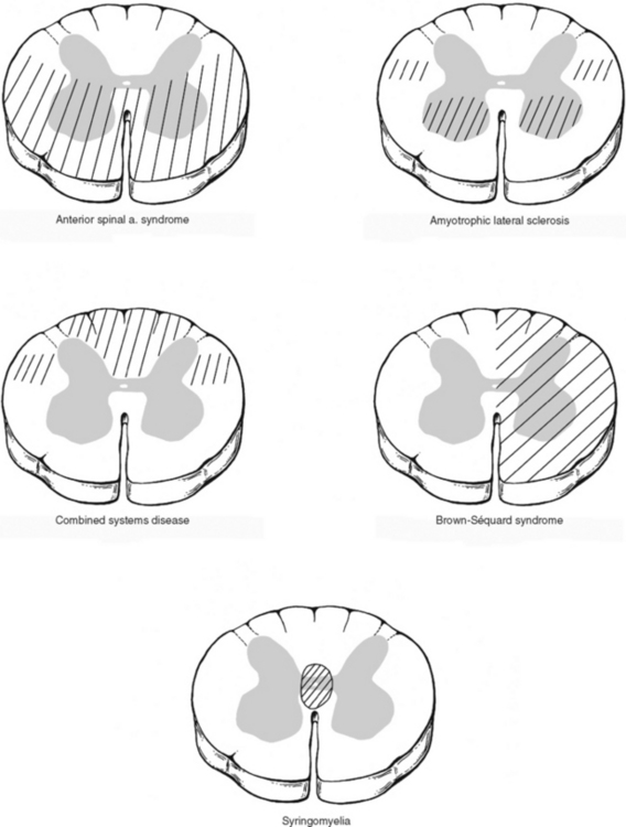 Surface Anatomy Of The Back And Vertebral Levels Of Clinically ...