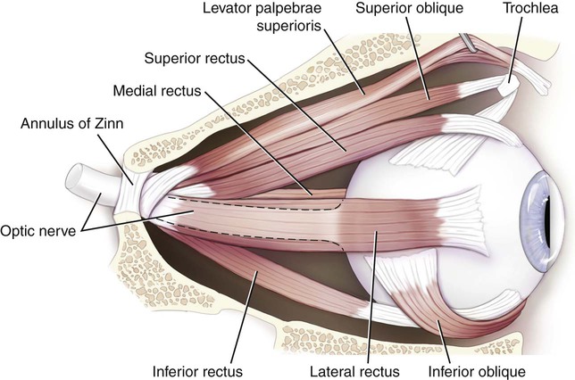 adnexa-parovarian-cyst-of-the-right-uterine-adnexa