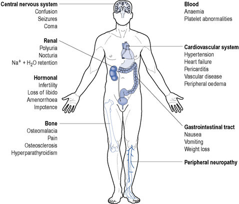 Chronic kidney disease and end'stage renal disease | Basicmedical Key