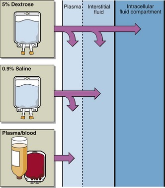 box diagram of body fluid compartments