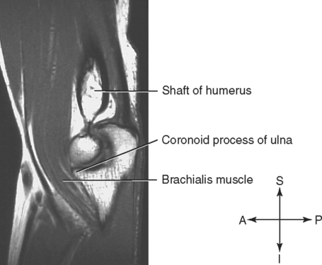 The Upper Extremity | Basicmedical Key