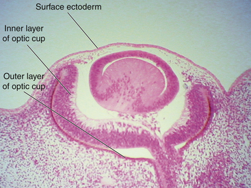 Ocular Embryology | Basicmedical Key