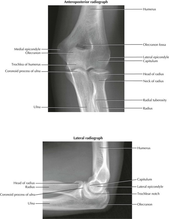 6: Upper Limb | Basicmedical Key