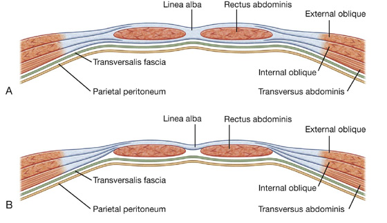 Abdomen Basicmedical Key