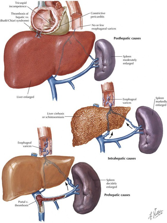 Pelvis And Perineum | Basicmedical Key