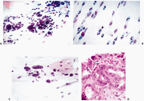 Soft Tissue Lesions | Basicmedical Key