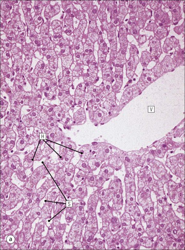 liver histology sinusoids
