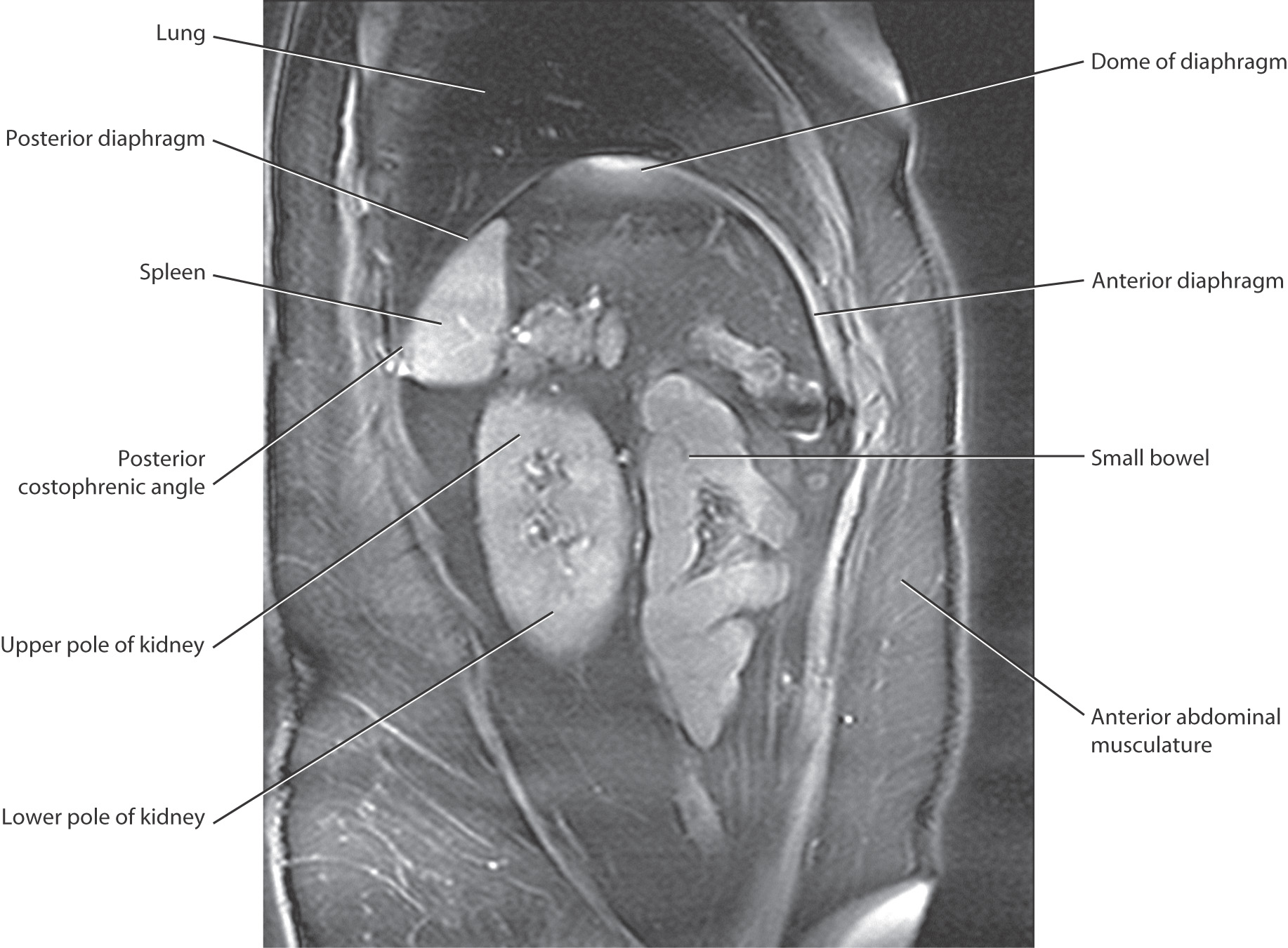 Diaphragm And Posterior Abdominal Wall | Basicmedical Key