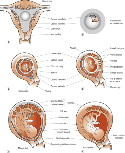 The placenta, membranes and amniotic fluid | Basicmedical Key