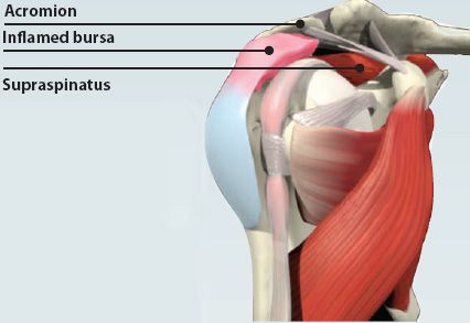 The tendon of the supraspinatus muscle