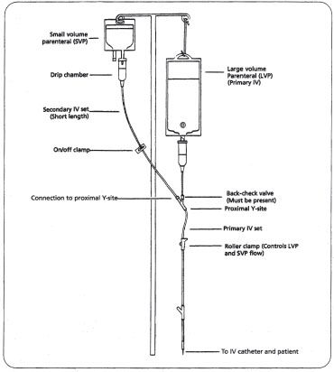 Piggyback system for intravenous therapy used in the hospital of the