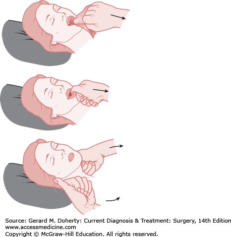 Management of the Injured Patient | Basicmedical Key