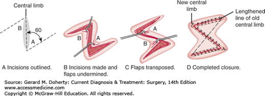 Plastic Reconstructive Surgery Basicmedical Key Plastic Reconstructive Surgery Basicmedical Key