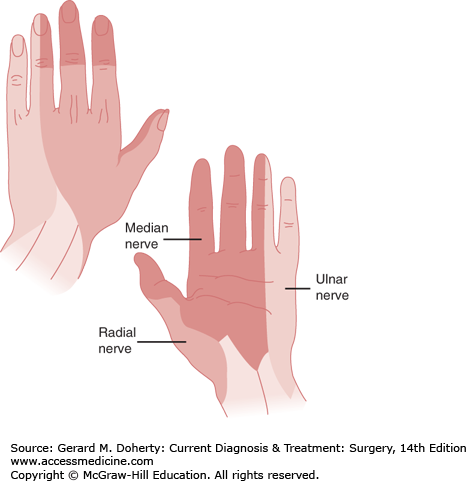 Hand Surgery | Basicmedical Key