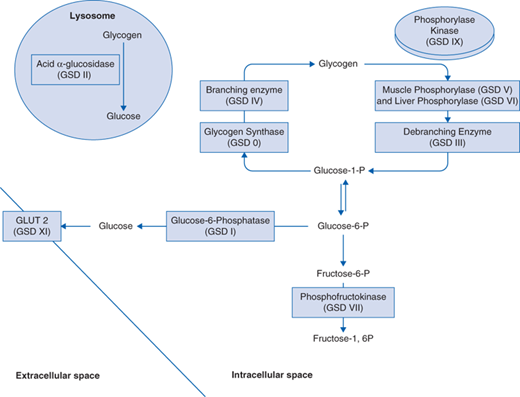 93: Glycogen Storage Disorders | Basicmedical Key