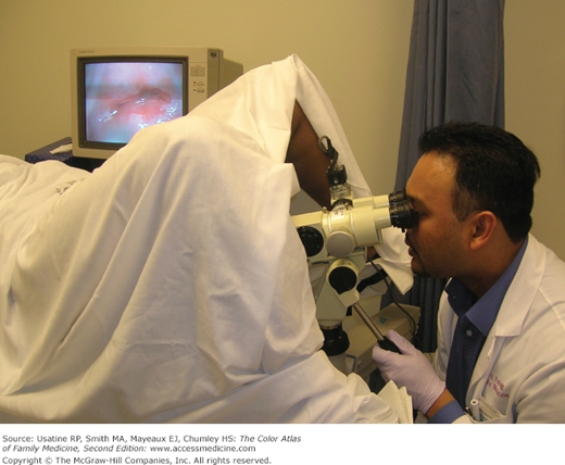 colposcopy-normal-and-noncancerous-findings-basicmedical-key