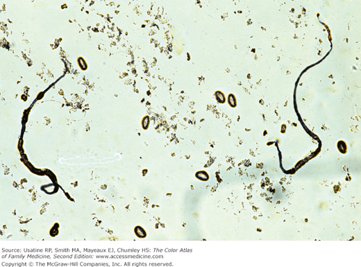 pinworms giardia roundworm