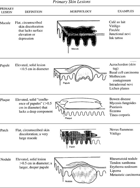 Skin Lesion Cheat Sheet