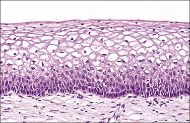 cervix transformation zone histology