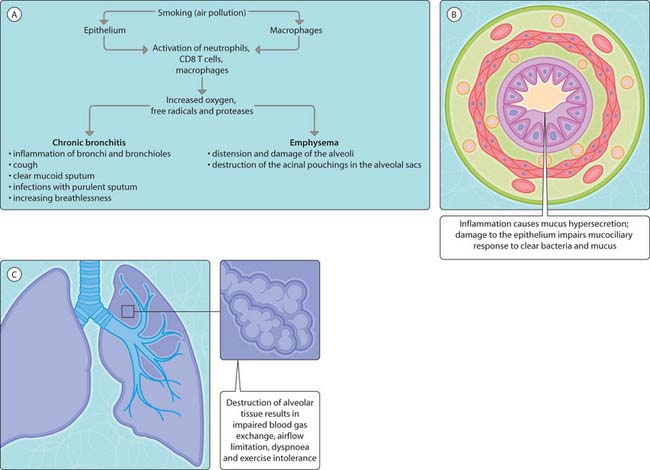 Respiratory System: Chronic Obstructive Pulmonary Disease ...