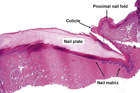 Diseases of the nails | Basicmedical Key