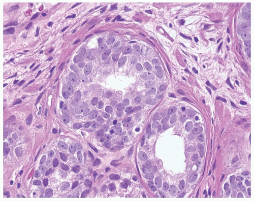 Prostate | Basicmedical Key