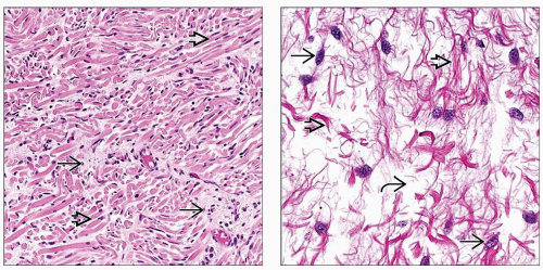 Connective Tissue | Basicmedical Key