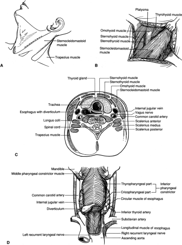 Operations for Zenker’s Diverticulum | Basicmedical Key