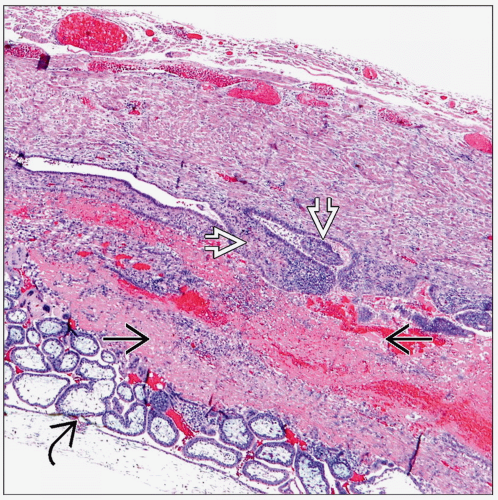 Parts Of Fallopian Tube Anatomy