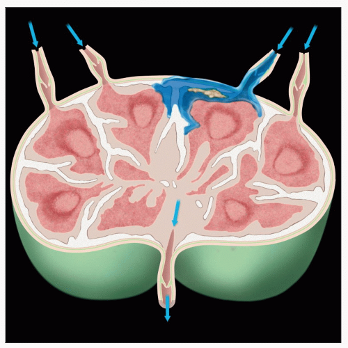 Lymph Nodes, Axillary: Diagnosis | Basicmedical Key