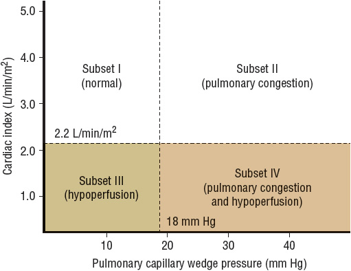 cardiac index