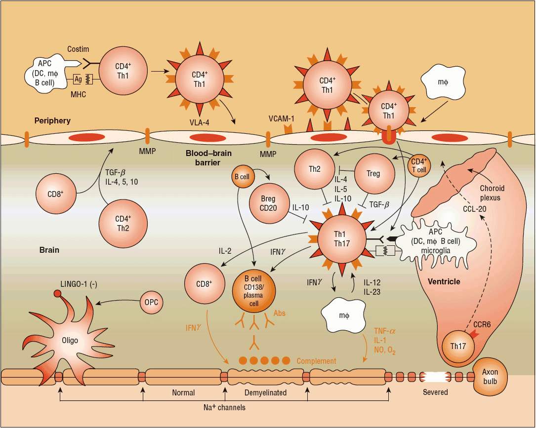 Pathogenesis Of Multiple Sclerosis