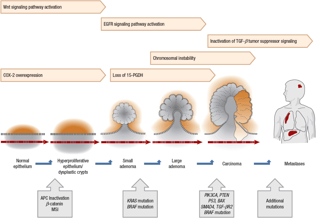 colorectal cancer gene mutation)