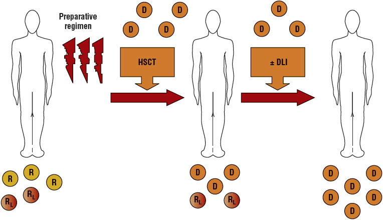 allogeneic stem cell transplant