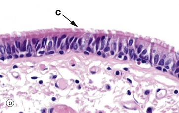 simple ciliated columnar epithelium
