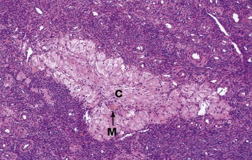 corpus albicans histology