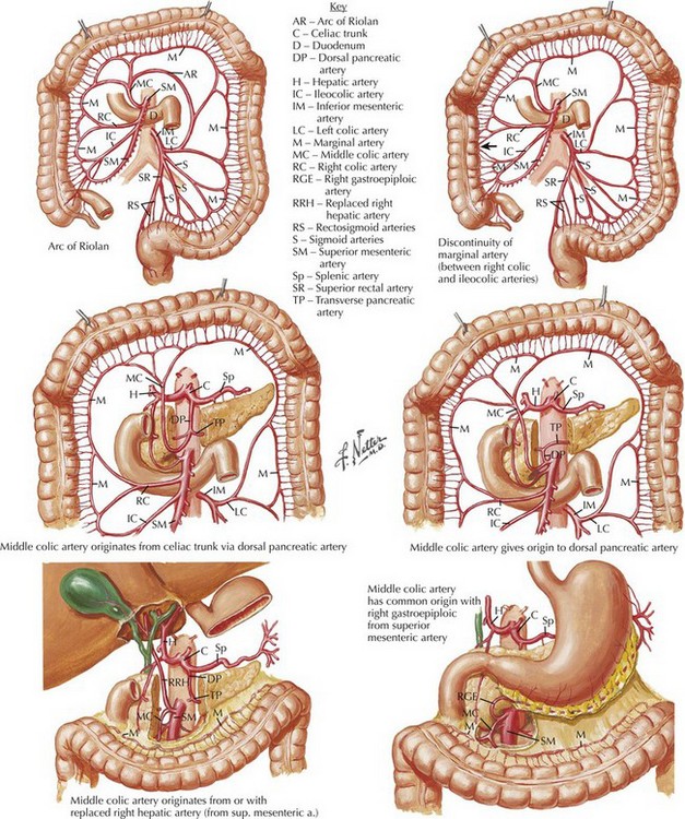 Hemorrhoids And Hemorrhoidectomy | Basicmedical Key