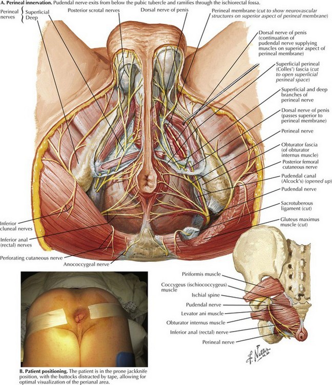 perirectal abscess