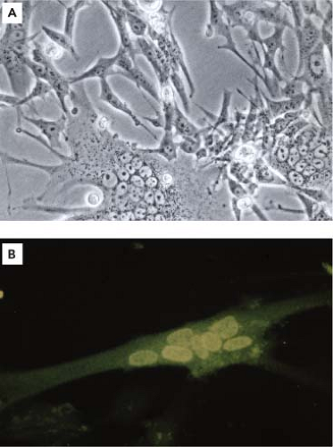 Foamy Viruses | Basicmedical Key