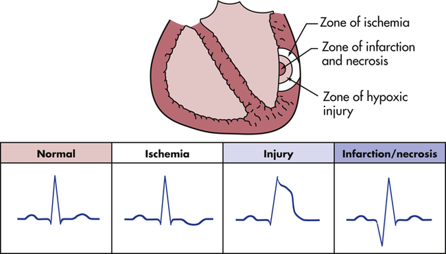 Structure And Function Of The Hematologic System | Basicmedical Key