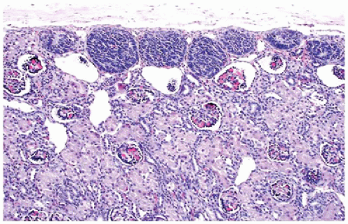 C17-FF43.gif | Basicmedical Key