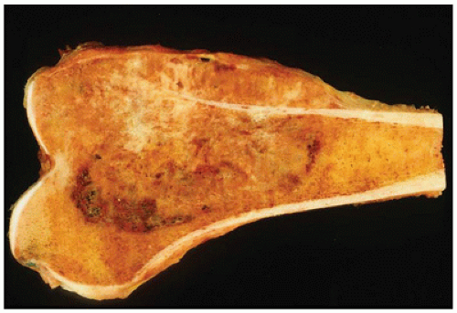 C28-FF26.gif | Basicmedical Key