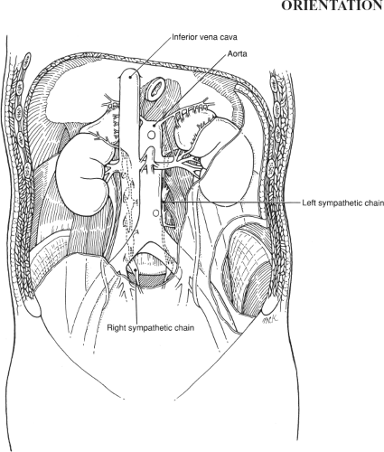 Lumbar Sympathectomy Basicmedical Key