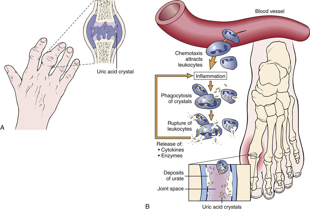 Structure And Function Of The Musculoskeletal System | Basicmedical Key