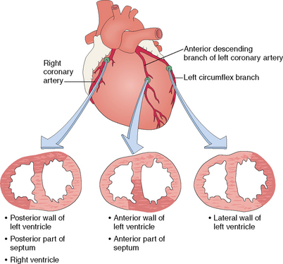 Cardiovascular Diseases Basicmedical Key