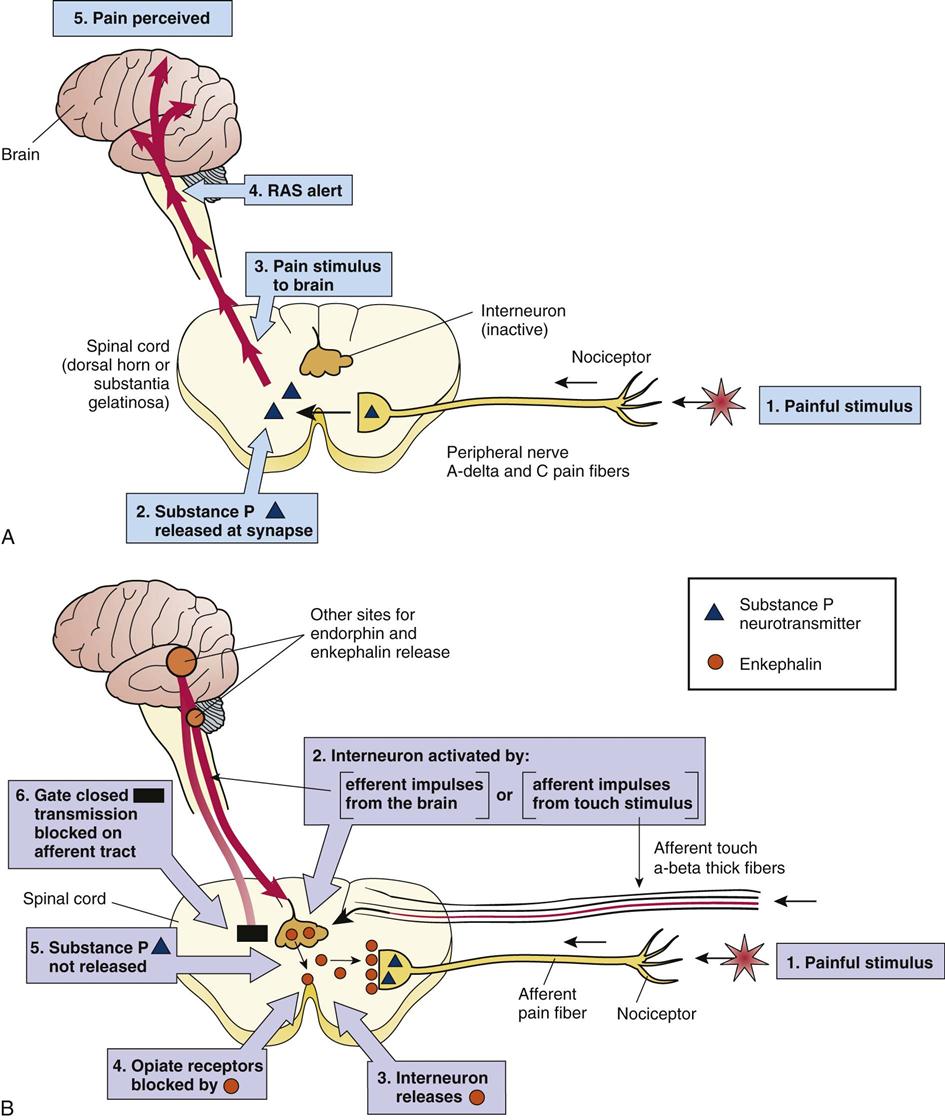 peripheral-neuropathy-what-it-is-symptoms-treatment