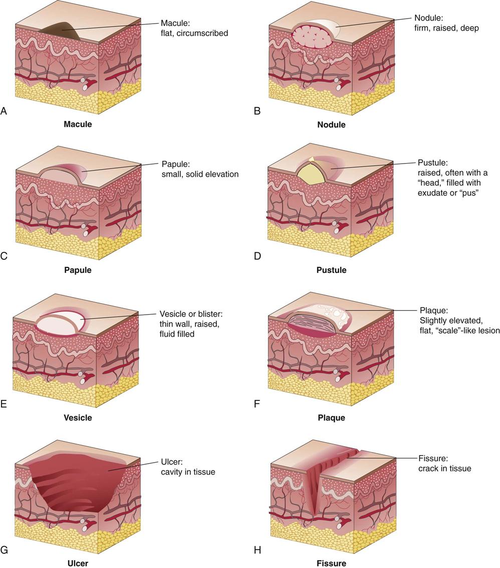 skin lesions chart