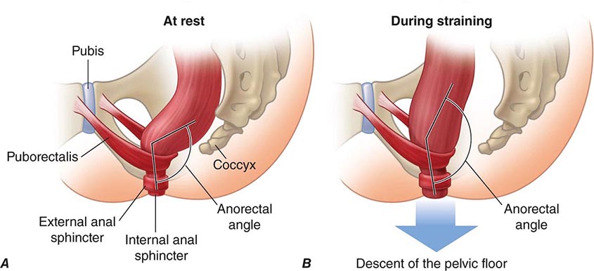 Anal Sphincter Exercise 87