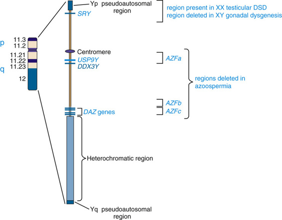 Sex Chromosomes And Their Abnormalities Basicmedical Key 2162